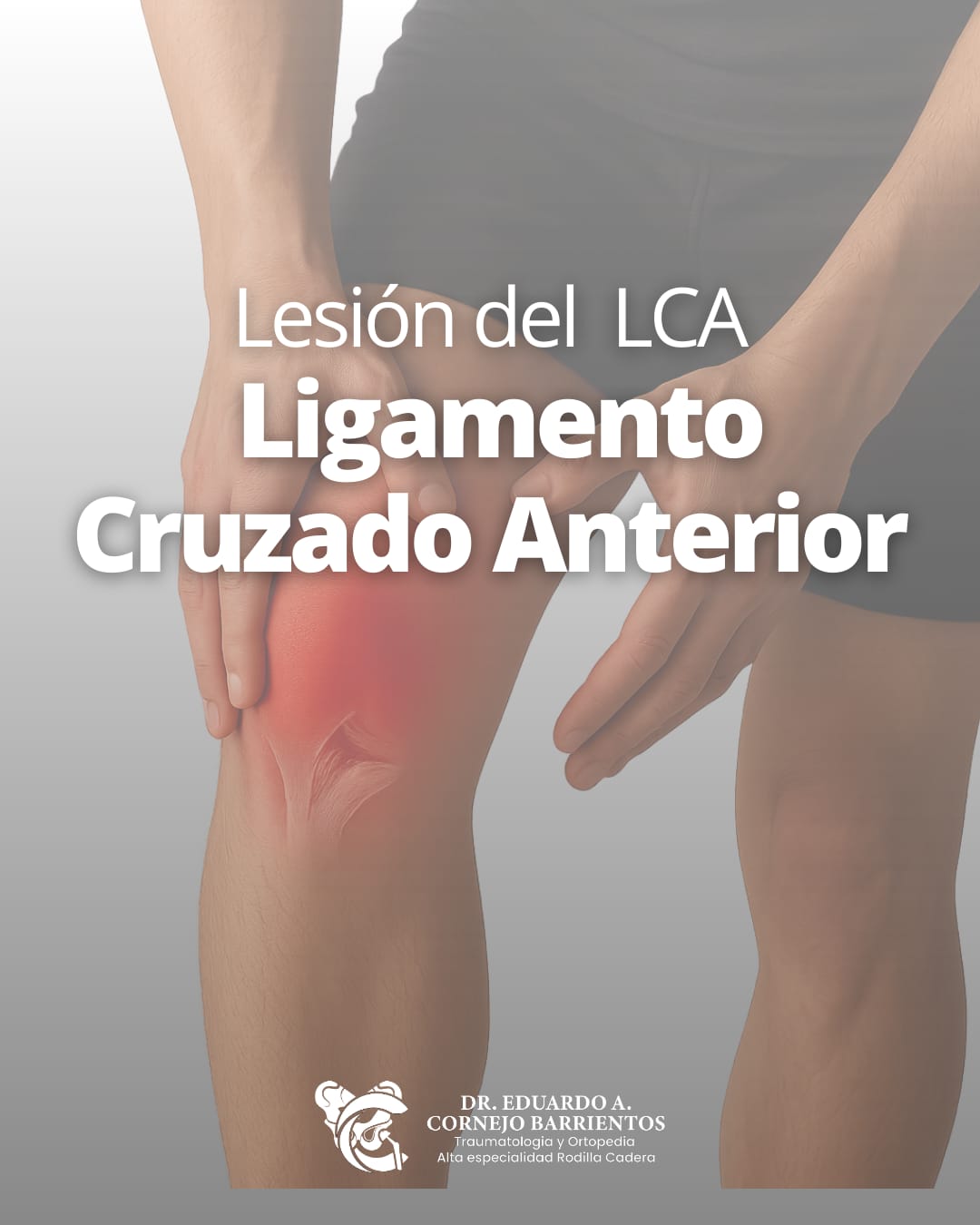 Lesión del ligamento cruzado anterior
